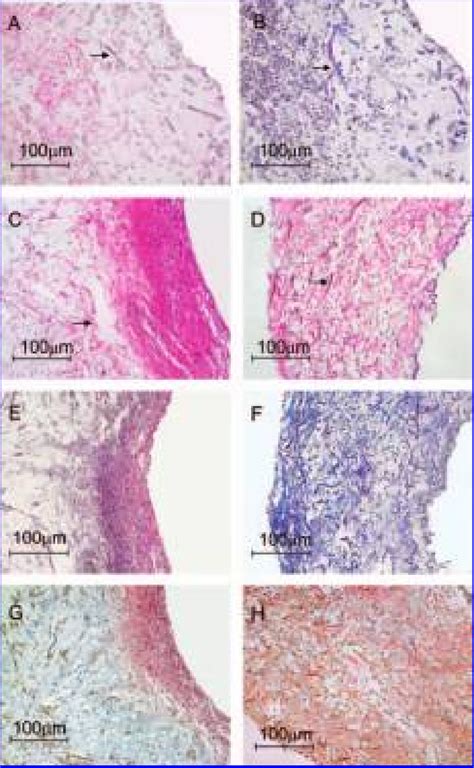 Histology Of Tissues Hematoxylin Eosin Hande Staining Of Statically