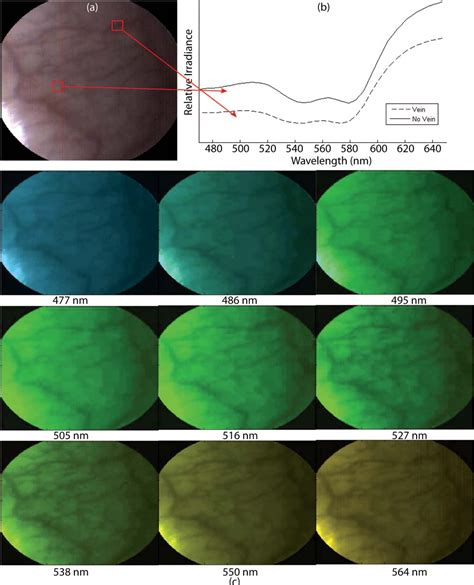 Figure From Real Time Snapshot Hyperspectral Imaging Endoscope