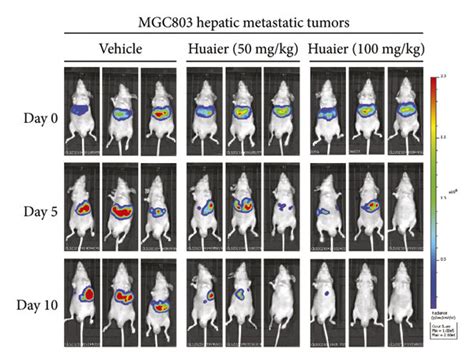 HBE inhibits the formation of hepatic metastasis. (a) Representative in ... 