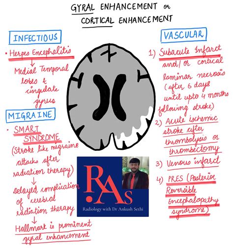 Gyral Enhancement Radiology With Dr Ankush Sethi