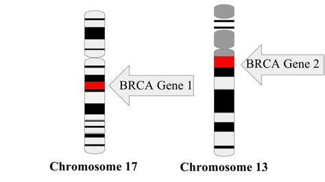 Before Angelina Jolie: Karen Malkin Lazarovitz's BRCA Journey (Part 1)