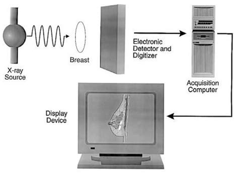 Schema Of A Digital Mammography System Download Scientific Diagram