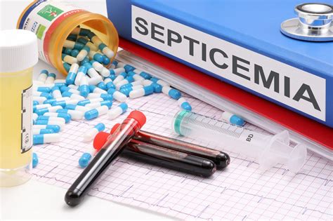 Difference Between Bacteremia And Septicemia Difference Between