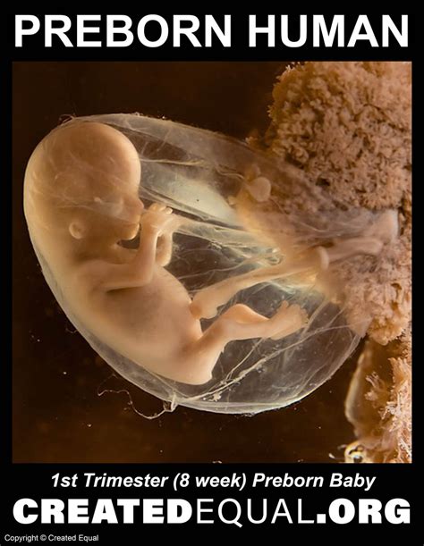 Preborn Baby Sign – Created Equal Store
