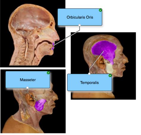 Correctly Label Each Of The Three Highlighted Muscles Greta Has Arias