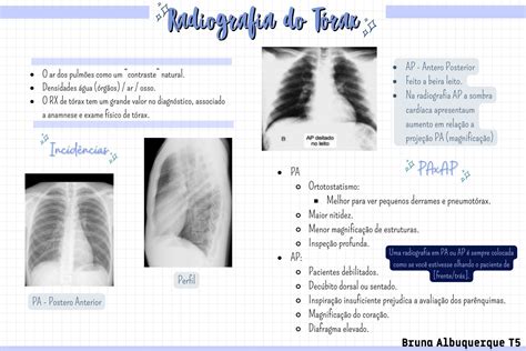 Solution Radiografia Do T Rax Studypool