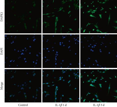 Inhibition Of Dapk1 Alleviates Il 1β Induced H9c2 Cell Injury