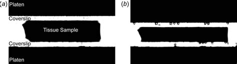 Light transmission image of a slice of the adult hippocampus prior to ... 