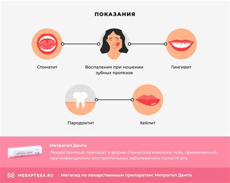 Метрогил дента гель инструкция по применению: От чего помогает, аналоги ...