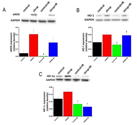 Vascular Reactivity In Old Spontaneously Hypertensive Stroke Prone Rats