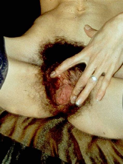 Skinny Slut With Hairy Pussy Sucking And Fucking Two Dicks Porn Pictures XXX Photos Sex Images