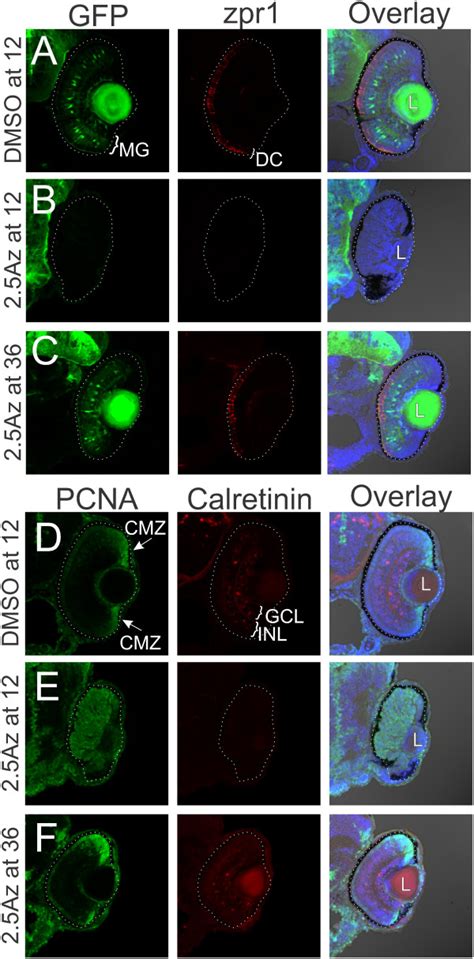 Inhibition of GSK3β blocks retinal differentiation and maintains