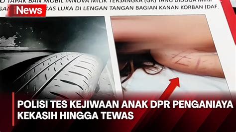 Polisi Tes Kejiwaan Tersangka Penganiayaan Kekasih Hingga Tewas Di