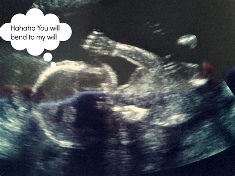 Ultrasound Funny Quotes. QuotesGram