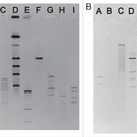 Pulsed Field Gel Electrophoresis Pfge Of Undigested And Restriction