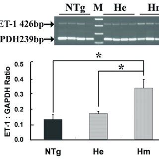 A Ethidium Bromide Stained Agarose Gels Of Rt Pcr Products Of Et