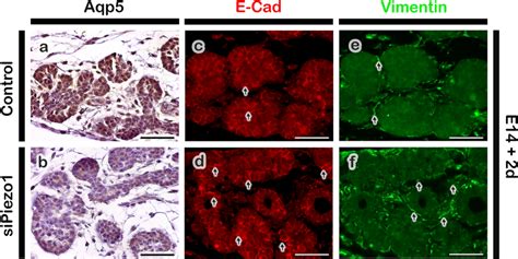 Altered Expression And Localization Patterns Of Salivary Glandrelated