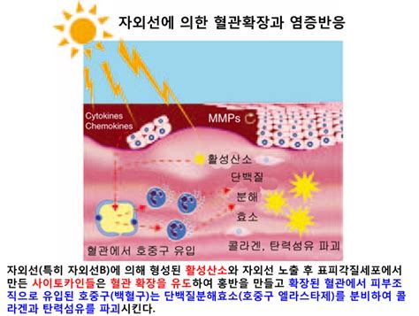 운동실조 모세혈관확장증 염색체