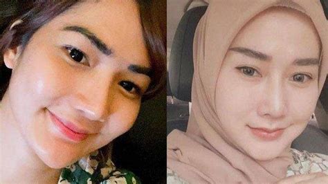 Irene Bermawi Sayangkan Sikap Ibunda Yang Bela Sang Adik Marissya Icha