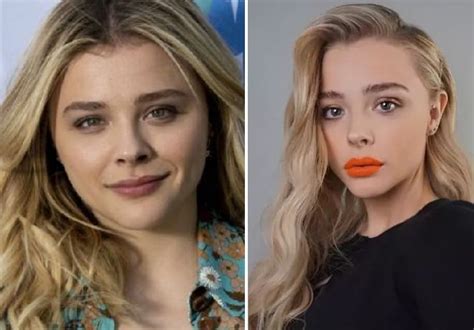 Chloë Grace Moretz Before And After Plastic Surgery Nose Face Teeth