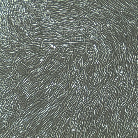 HDF Human Dermal Fibroblasts Adult CellSystems