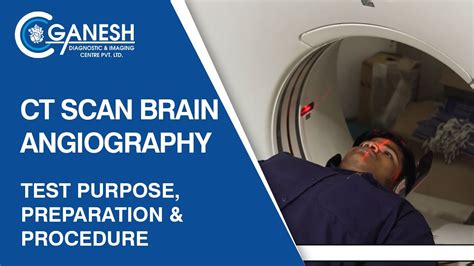 Ct Scan Brain Angiography Test Purpose Preparation And Procedure