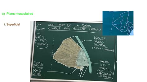 SOLUTION Anatomie Du Membre Inf Rieur Studypool