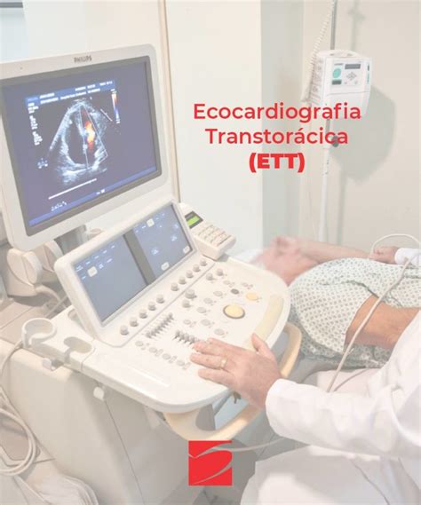 Ecocardiografia Transtor Cica Icor Instituto Do Cora O De Santa Maria