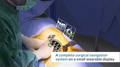 FDA Cleared Augmented Reality Surgical Guidance Solve Hands Free