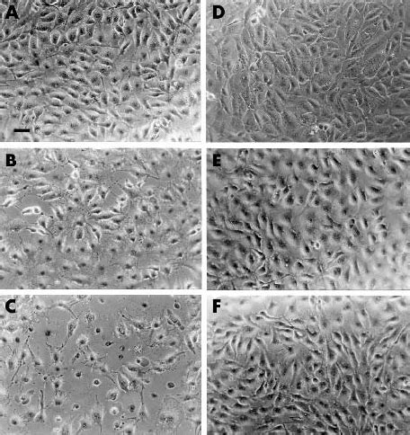 Cultured Human Rpe Cells Were Exposed To Icg Dissolved In Bss Or Na