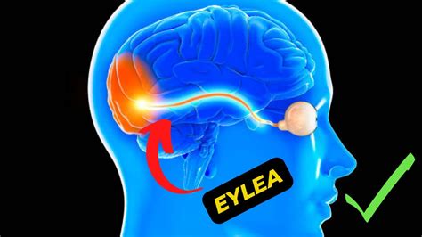 Eylea The Revolutionary Treatment For Wet Age Related Macular