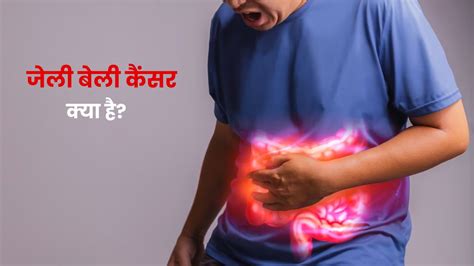 जेली बेली कैंसर क्या है जानें इसके कारण लक्षण और इलाज What Is Jelly