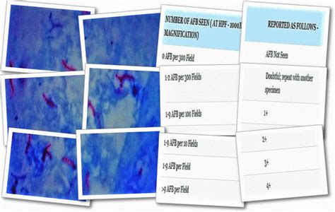 Agglutination Vs Precipitation 20 Differences Laboratory Hub