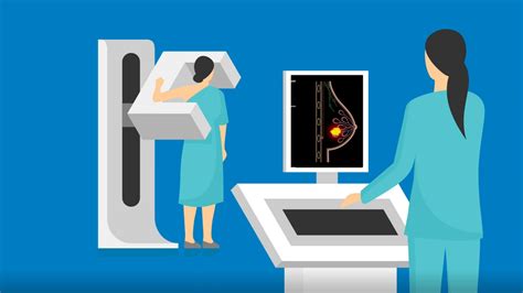 Munson Minute 3d Mammography Explained Wpbn