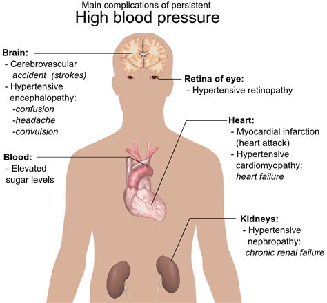 High Blood Pressure Hypertension Drthinds Homoeopathy