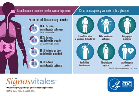 Enfermedades Infecciosas Septicemia