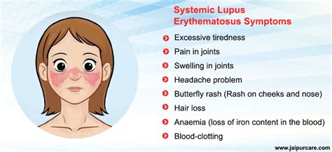 Systemic Lupus Erythematosus Treatment In Jaipur by Dr Bhupendra