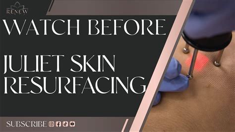 What To Expect Juliet Laser Skin Resurfacing Significant