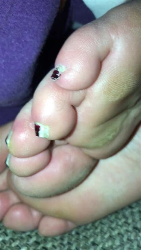 Amateur Milf Dry Sleeping Soles And Feet Pov ThisVid