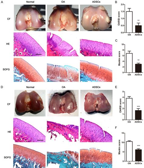 Macroscopic Examination And Histological Assessment Of Intra Articular