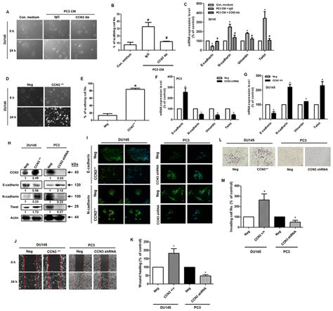 Overexpression Or Knockdown Of Ccn3 Affects Emt In Pca Cells A The