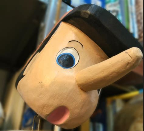 Boy With Same Nose Condition As Boris Johnson Still Waiting For Nhs Op