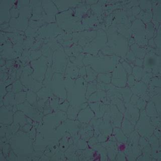 Histological Examination Reveals Mature Adipose Tissue H E 40