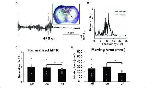 High Frequency Deep Brain Stimulation Dbs Hfs Effect In Download Scientific Diagram