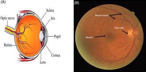 (A) Anatomy of eye; (B) fundus image. | Download Scientific Diagram