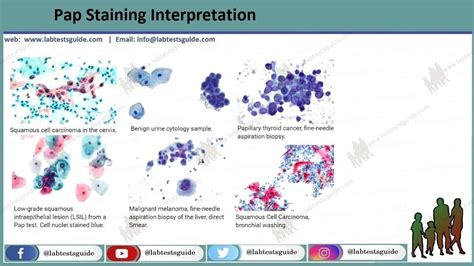 Papanicolaou Stain Procedure Result Interpretation And More Ltg