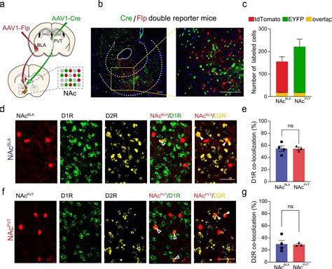 How The Nucleus Accumbens Mediates Positive And Negative Motivational