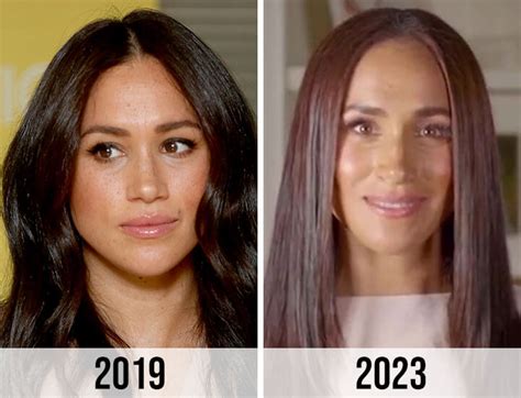 Meghan Markle Plastic Surgery The Royal Transformation