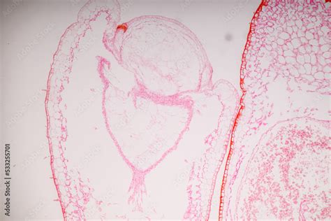 Plant tissue Structure, section (tissue) of stem plant tissue under a ...