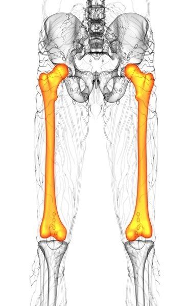 La Frattura Del Femore Diagnosi E Cura Crosystem